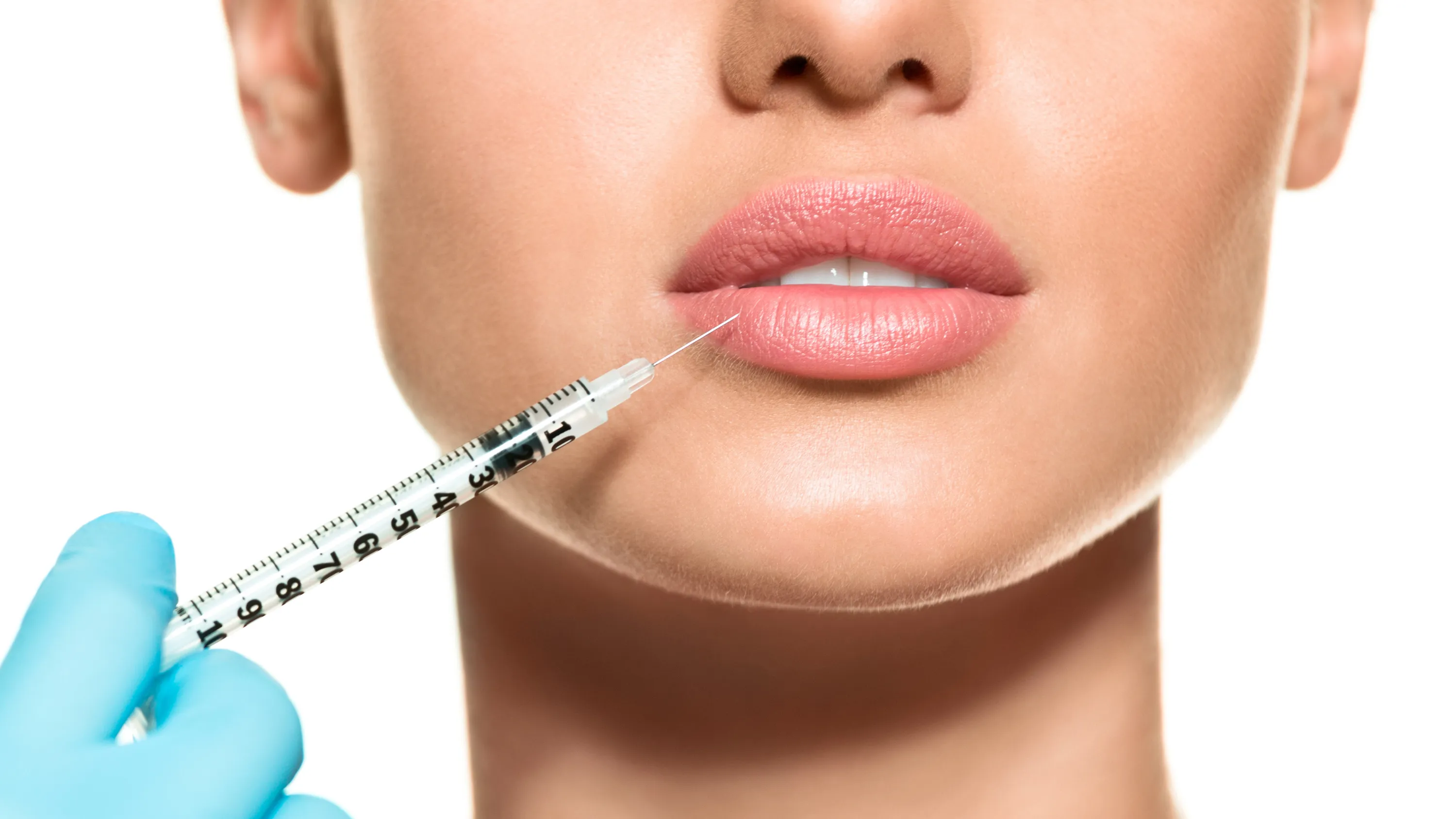 قیمت تزریق فیلر لب در اصفهان | کلینیک زیبایی روژا