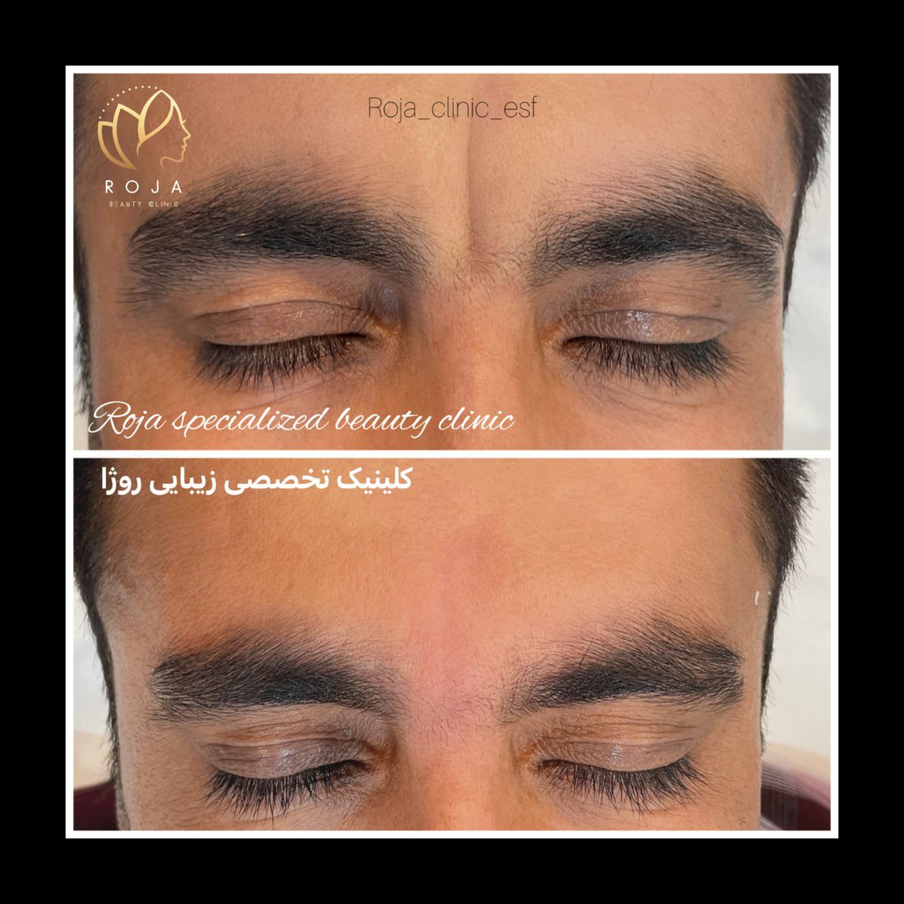کلینیک زیبایی روژا