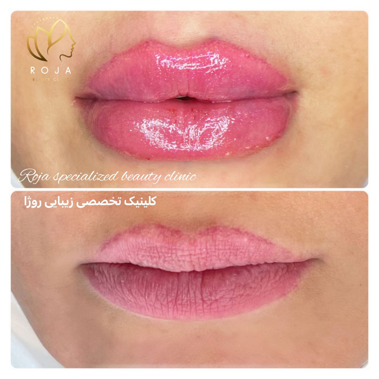 کلینیک زیبایی روژا