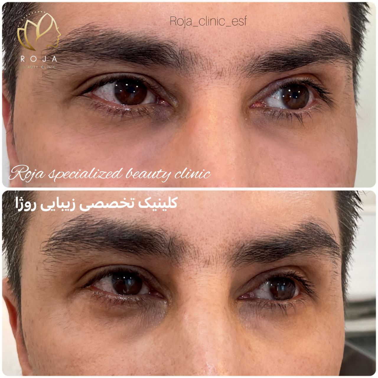 کلینیک زیبایی روژا