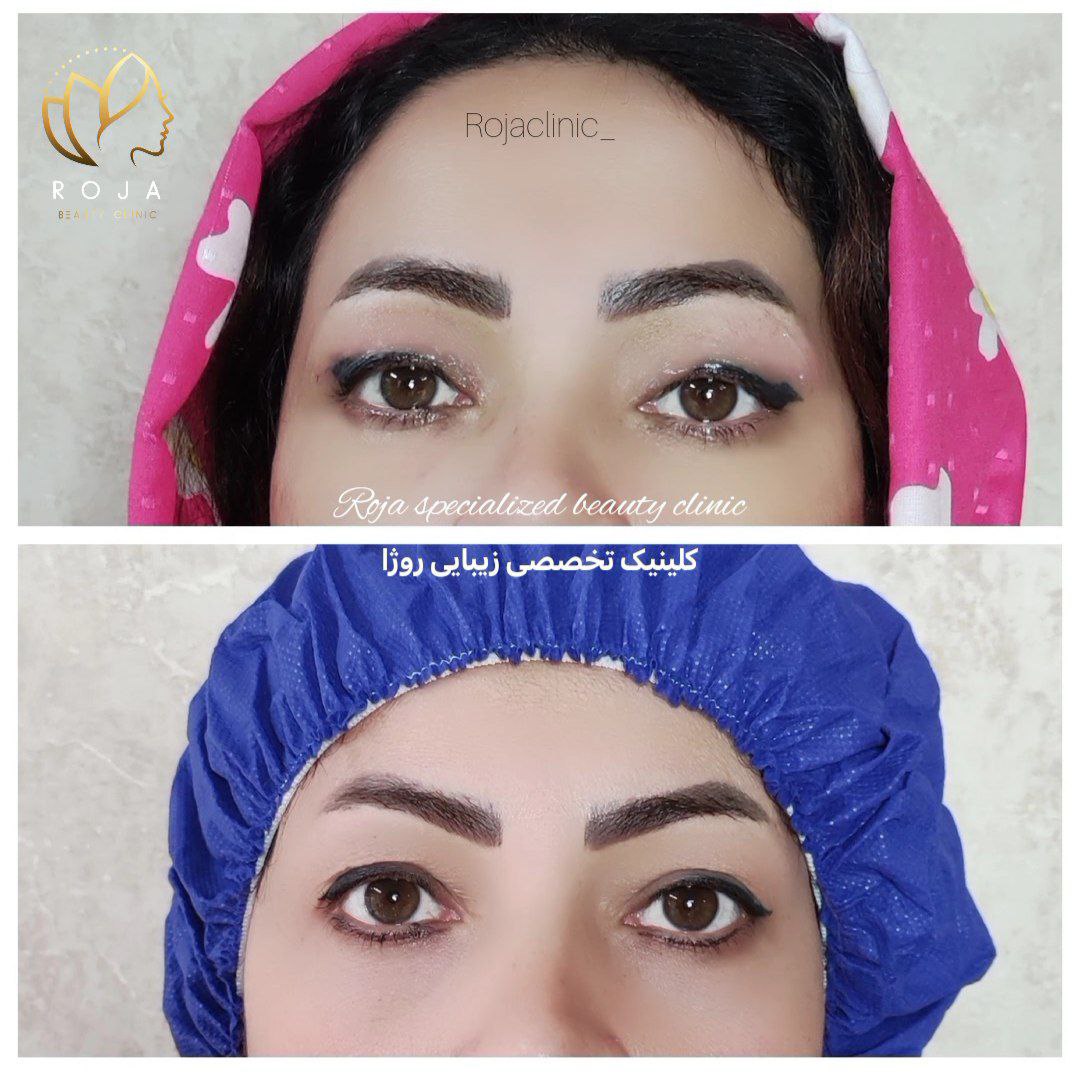کلینیک زیبایی روژا