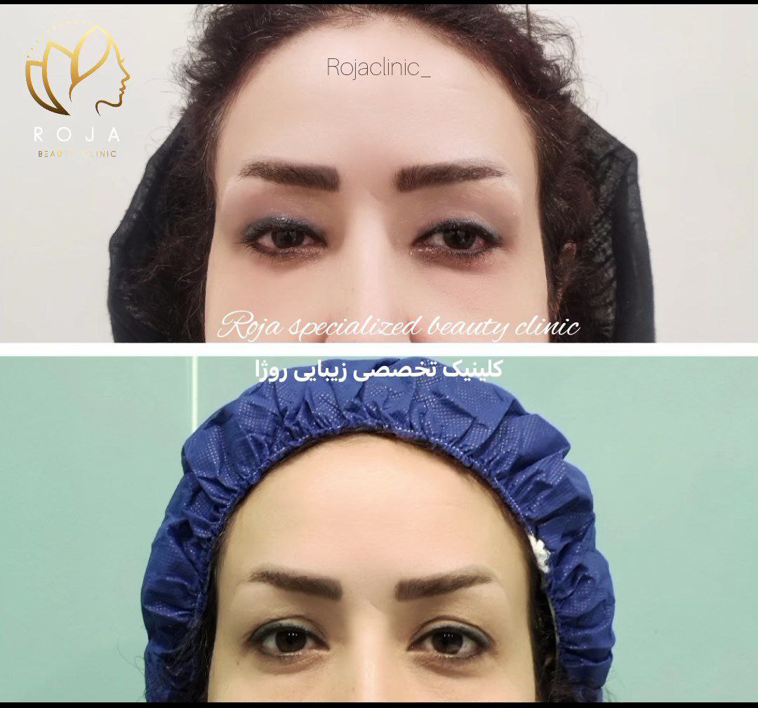 کلینیک زیبایی روژا