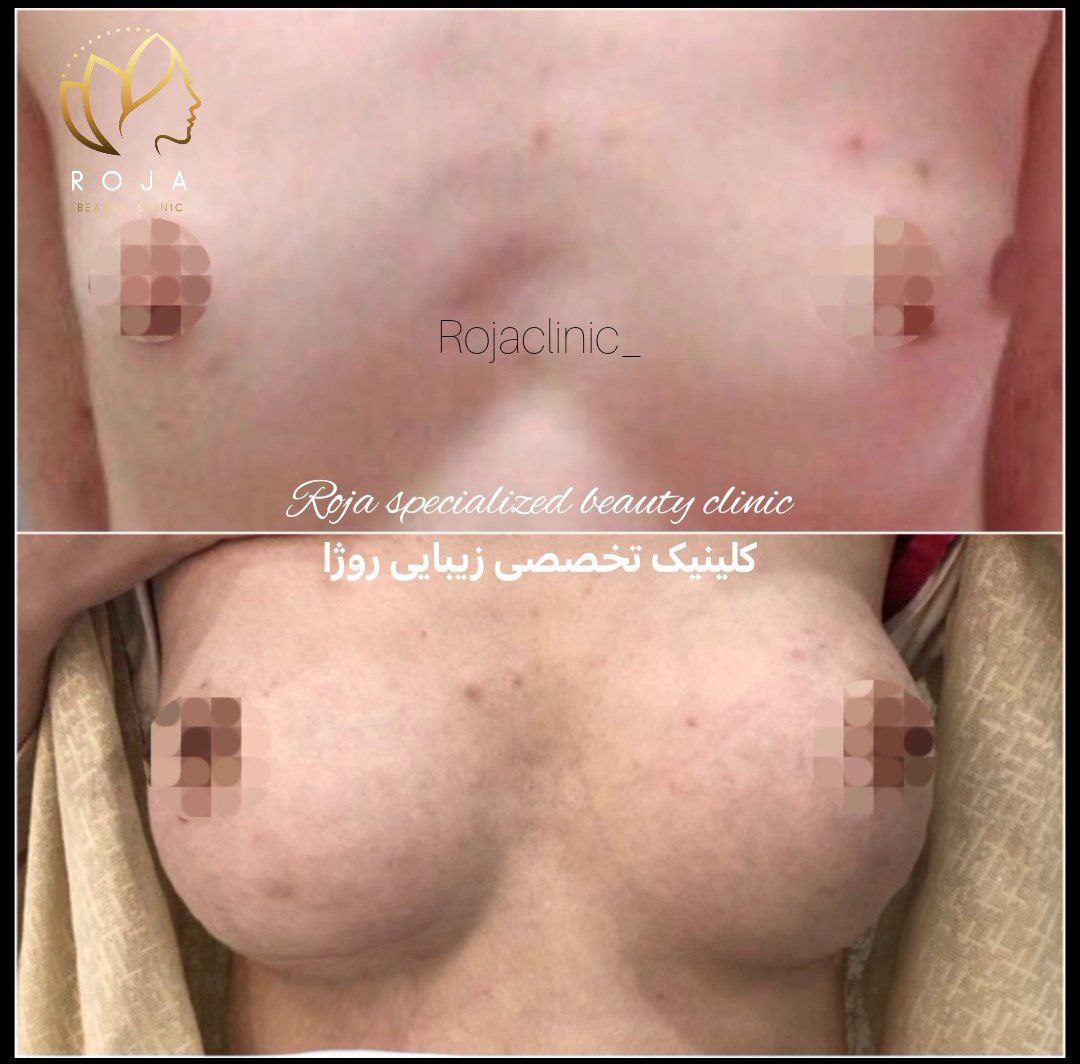 کلینیک زیبایی روژا